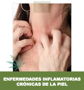 Enfermedades inflamatorias crónicas de la piel