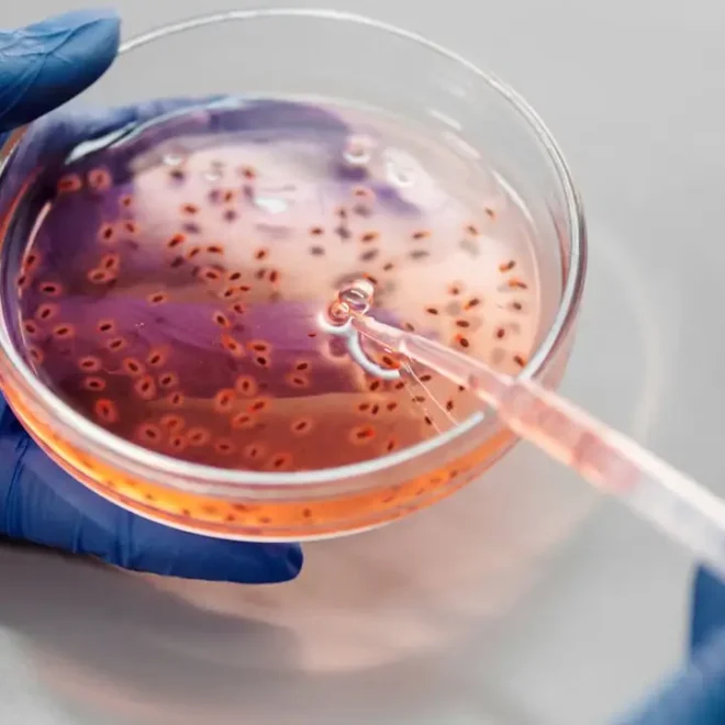 Bacterias orales podrían estar vinculadas al desarrollo del Parkinson